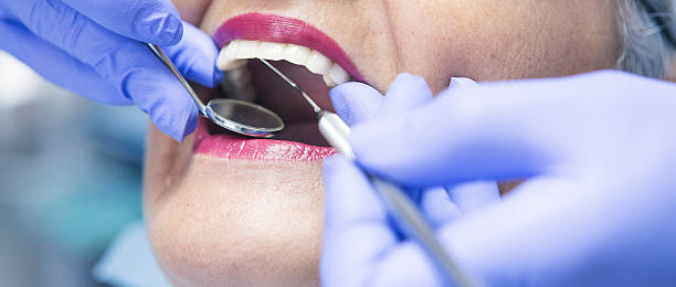 Best Emergency Dental Care for Broken or Chipped Teeth in Grant, AL